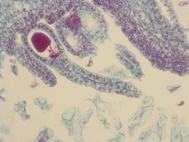 Liverwort Archegonia CS Slides - Liverwort Archegonia CS 01 400X